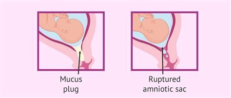 Mucus plug and water breaking