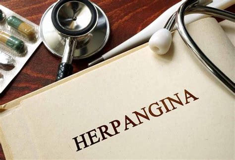 Herpangina in Kids: Reasons, Signs, Treatment & Prevention