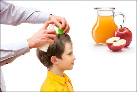 4 Ways to Use Apple Cider Vinegar for Head Lice Treatment