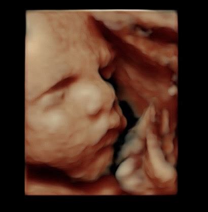 29 Week Ultrasound - Reveal 3D/4D Ultrasound Studio