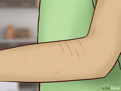 5 Ways to Deal With a Cat Scratch - wikiHow