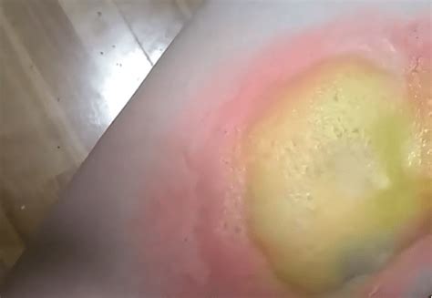 Boil popping videos – Artofit