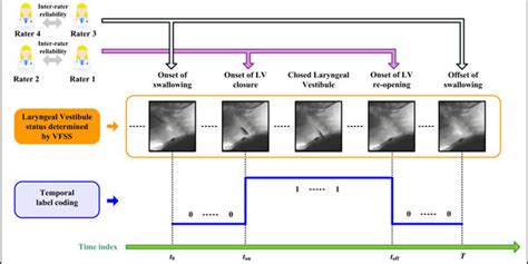 Automatic Estimation of Laryngeal Vestibule Closure Duration Using High-Resolution Cervical ...