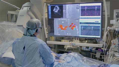 Complex ablation procedure - BroadcastMed