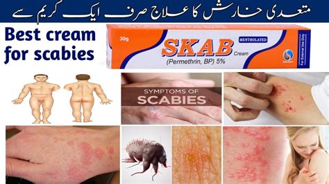 Skab Cream Uses. Permethrin cream 5% uses and side effects in Urdu Hindi. Scabies treatment ...