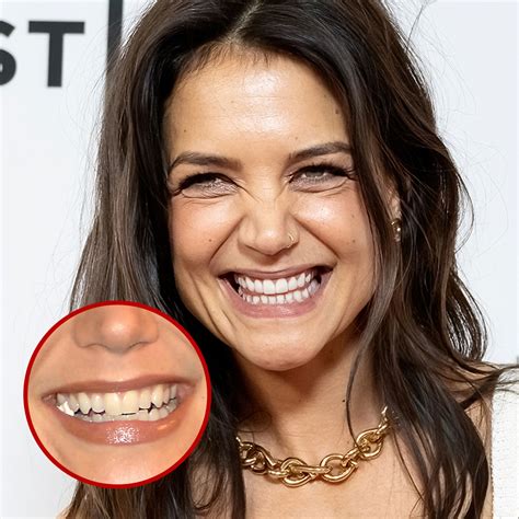 21 Celebrity Dental Implants And Veneers: Before And After - SHEfinds