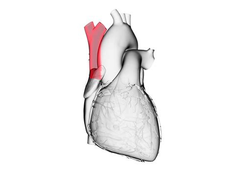 Superior Vena Cava: Anatomy and Related Conditions