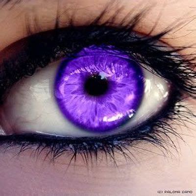 Purple Eye Disease - Symptoms And Causes