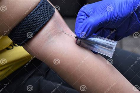 Blood Collection Using Venipuncture Technique Stock Image - Image of sample, inserted: 205904535