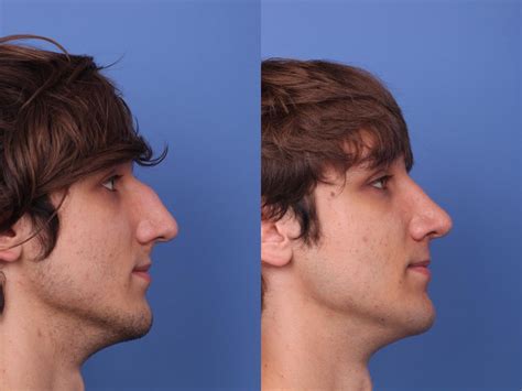 What's the Difference Between Male and Female Faces? | Phoenix & Scottsdale, AZ| Hobgood Facial ...