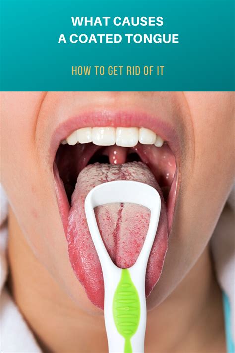 What Causes a Coated Tongue: How to Get Rid of It | Healthy tongue ...