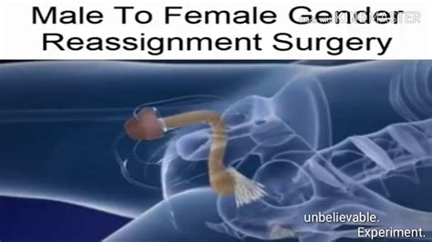 Male To Female Gender Reassignment Surgery - YouTube