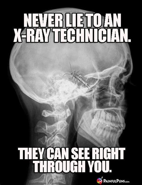 Never lie to an X-ray technician. They can see right through you ...