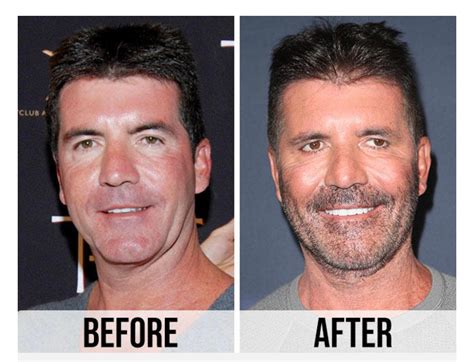 Simon Cowell after years of Botox. : r/oddlyterrifying