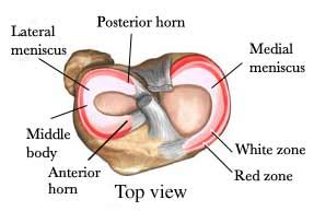 Posterior Horn Meniscus Tears