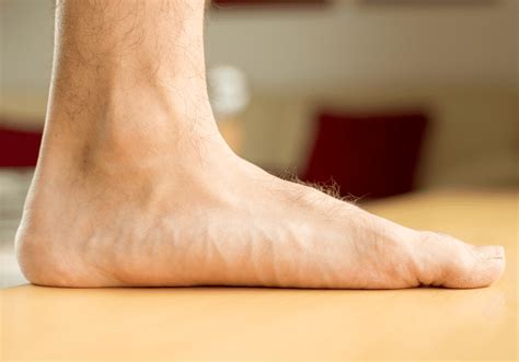 Pronation and Flat Feet - Foot Mechanics