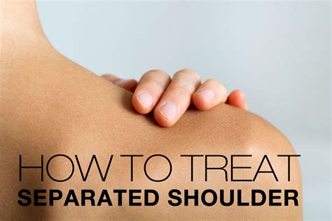 Shoulder Separation: Symptoms, Causes, Treatment By Shoulder Separation Braces