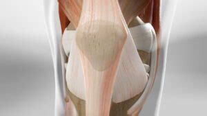 Lateral Release and Medial Imbrication - TXOSA