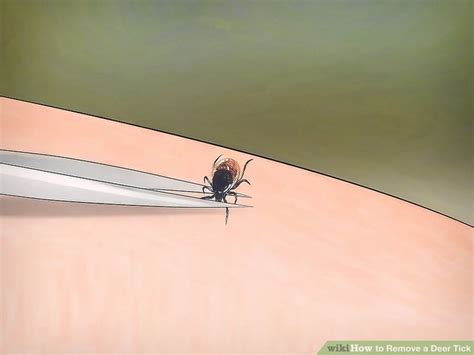 3 Ways to Remove a Deer Tick - wikiHow