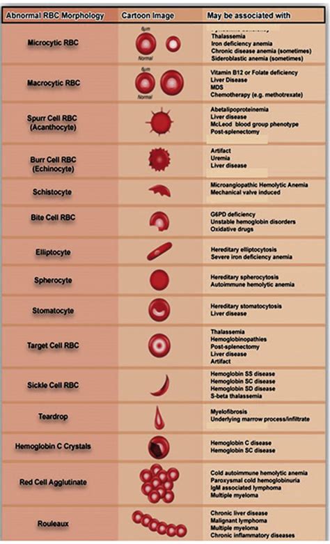 EUH Morning Report: What are common abnormal red blood cell morpologies, and which diseases are ...