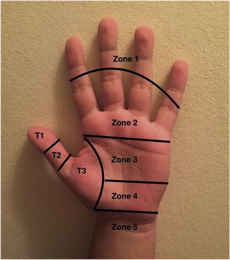 Hand Tendon Anatomy Diagram