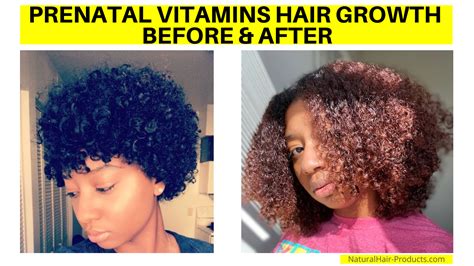 MSM Hair Growth Before and After Pictures [MSM Powder & Oil Results]