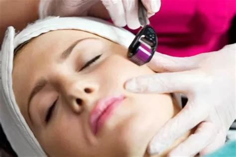 Microdermabrasion Cost | Blog | EllEve Med Spa