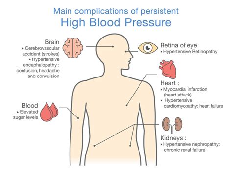 How Hawthorn Lowers Blood Pressure - Suzy Cohen, RPh offers natural remedies to help you feel ...