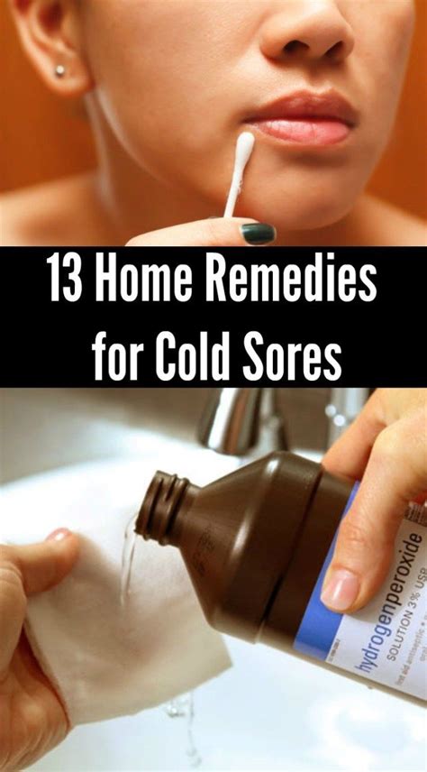 13 Home Remedies for Cold Sores | Cold home remedies, Cold sore, Cold remedies