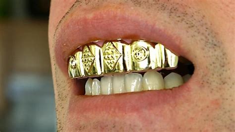 How Do You Make Gold Teeth at Home? | Custom gold jewelry, Gold jewellery design, Custom silver ...