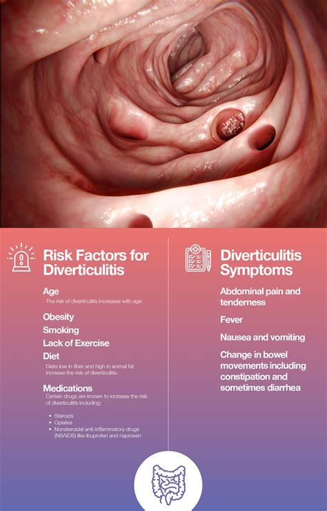 Diverticulitis Surgery