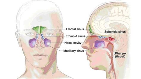 How to tell if you've got a sinus infection | Sinusitis, Sinus ...