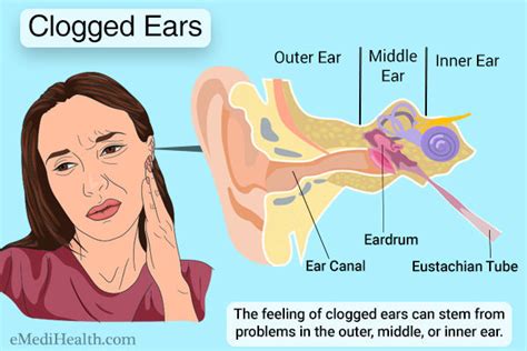 How To Get Sinus Drain From Ears - Best Drain Photos Primagem.Org