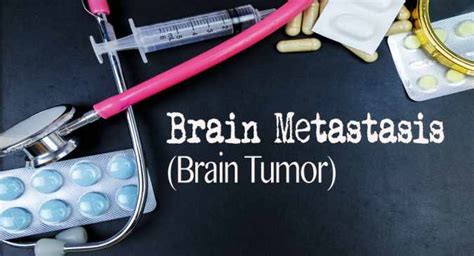 World Brain Tumour Day: Treatment of aggressive brain cancer | TheHealthSite.com