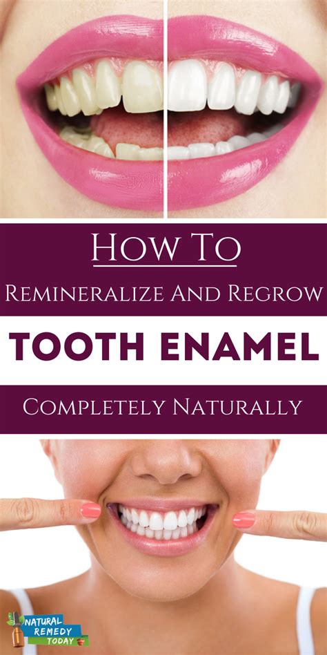 How To Remineralize And Regrow Tooth Enamel Naturally! | Tooth enamel ...