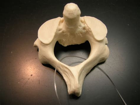 Axis Vertebra Diagram | Quizlet