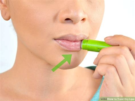 How to Treat Dry Lips: 15 Steps (with Pictures) - wikiHow