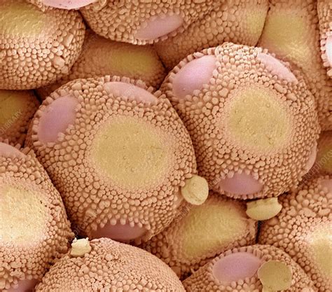 Rust fungus infection, SEM - Stock Image - C014/8931 - Science Photo ...