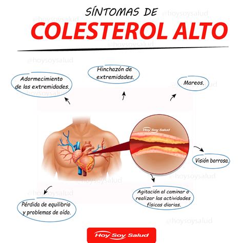 ﻿Síntomas de Colesterol Alto que debes tomar en cuenta. HOYSOY.NET ️