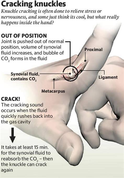 The Real Reason Behind Knuckle Cracking Explained