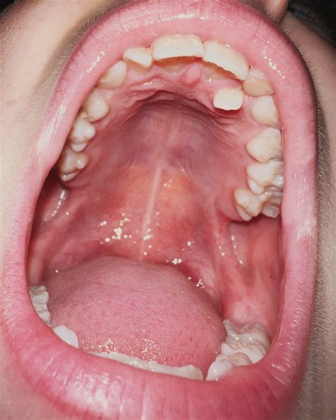 shark teeth – Yves Borgwardt