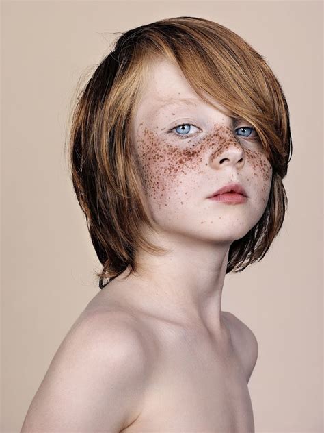 Freckles: Brock Elbank's striking portraits – in pictures | Beautiful ...