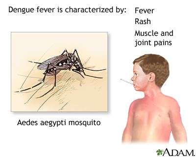 Dengue fever: MedlinePlus Medical Encyclopedia Image