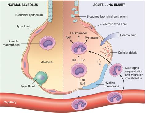 Acute trauma - palacepastor