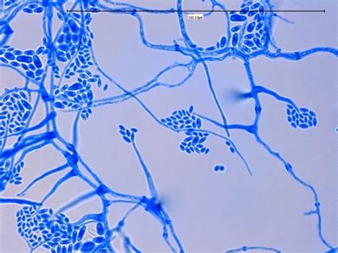 Fun With Microbiology (What's Buggin' You?): Acremonium species