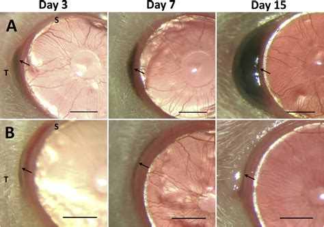 Photographs of tumor over time. (A) Tumor-bearing eye showing steady ...