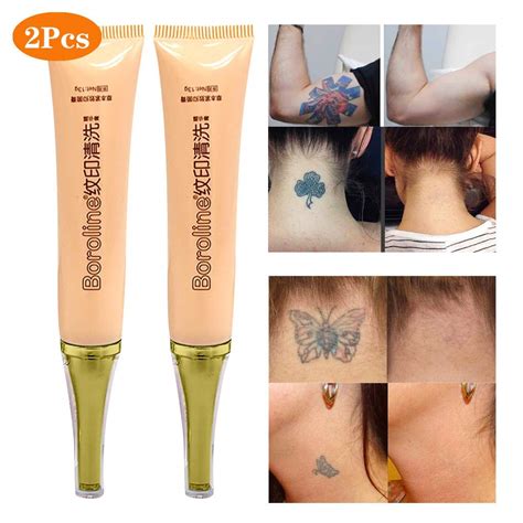 Tattoo Removal Cream - TATTOOS