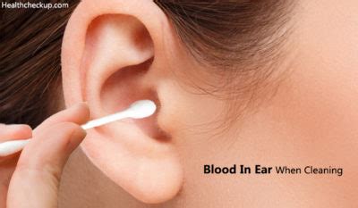 Blood in Ear When Cleaning - Causes, Diagnosis, Treatment, Tips