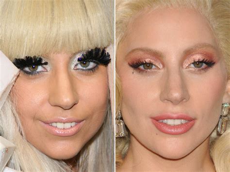 Lady Gaga Before and After - The Skincare Edit