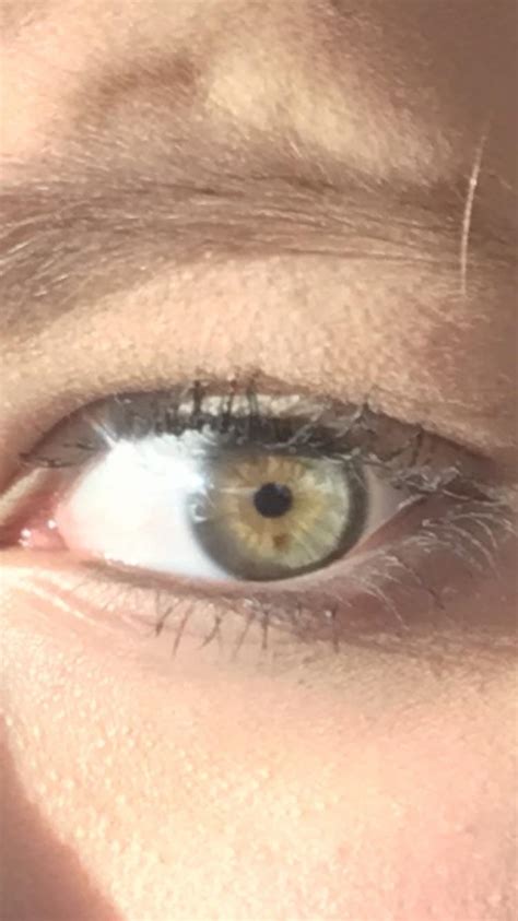 i have a freckle in my eye. : r/mildlyinteresting